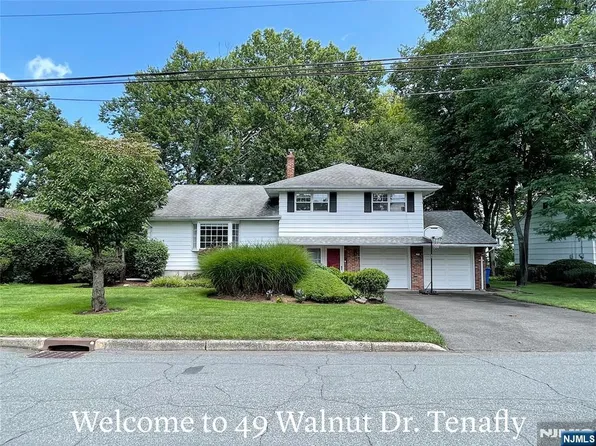 49 Walnut Dr, Tenafly, NJ 07670