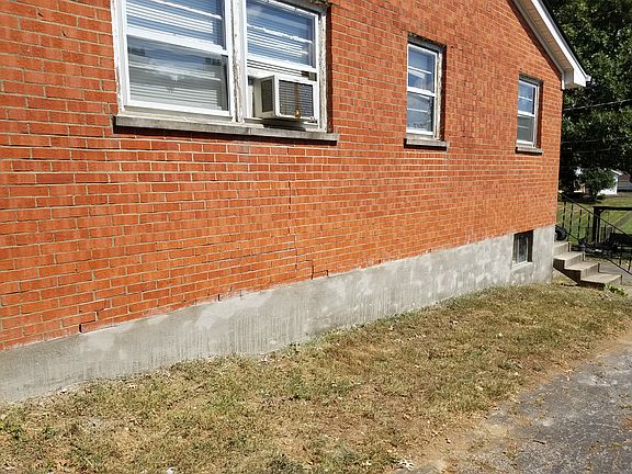 Newly cemented (9/19)