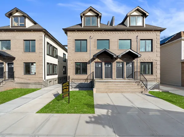 1335 East 65th Street image 1 of 18