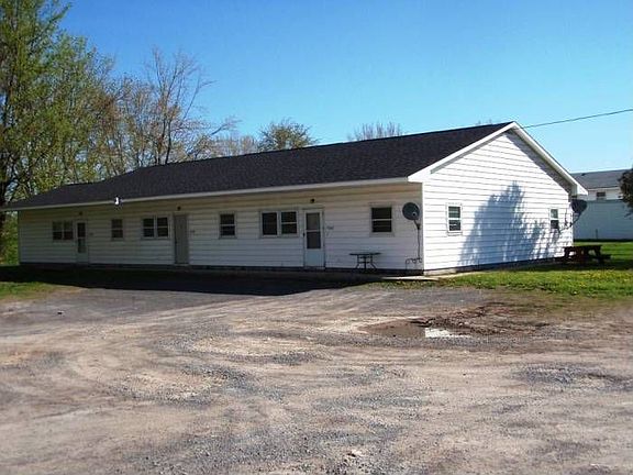 Front view of right side