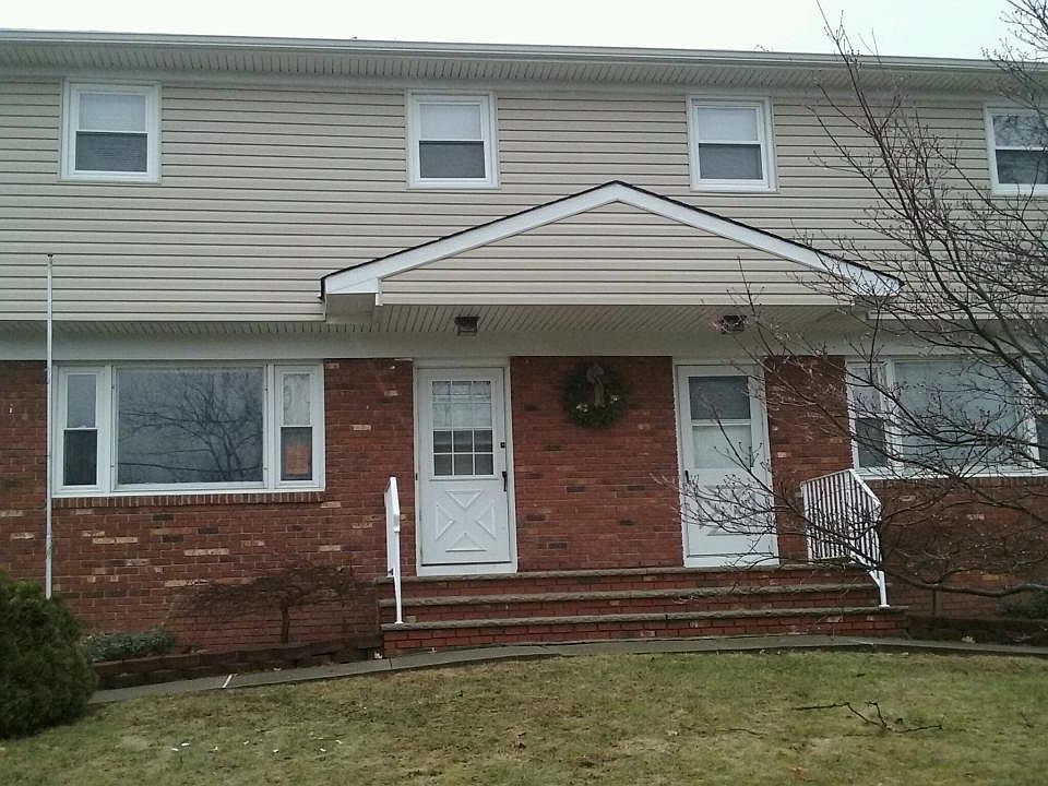 Right side
