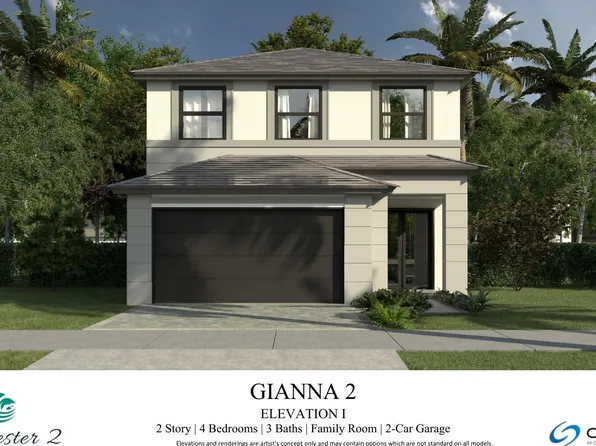 Gianna II Plan, Century Westchester