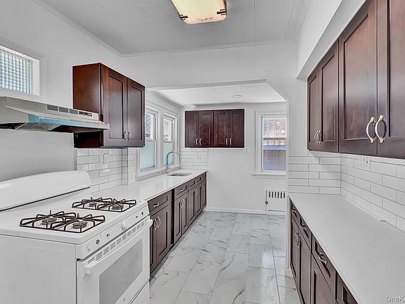 5th image of 100 Irving Avenue