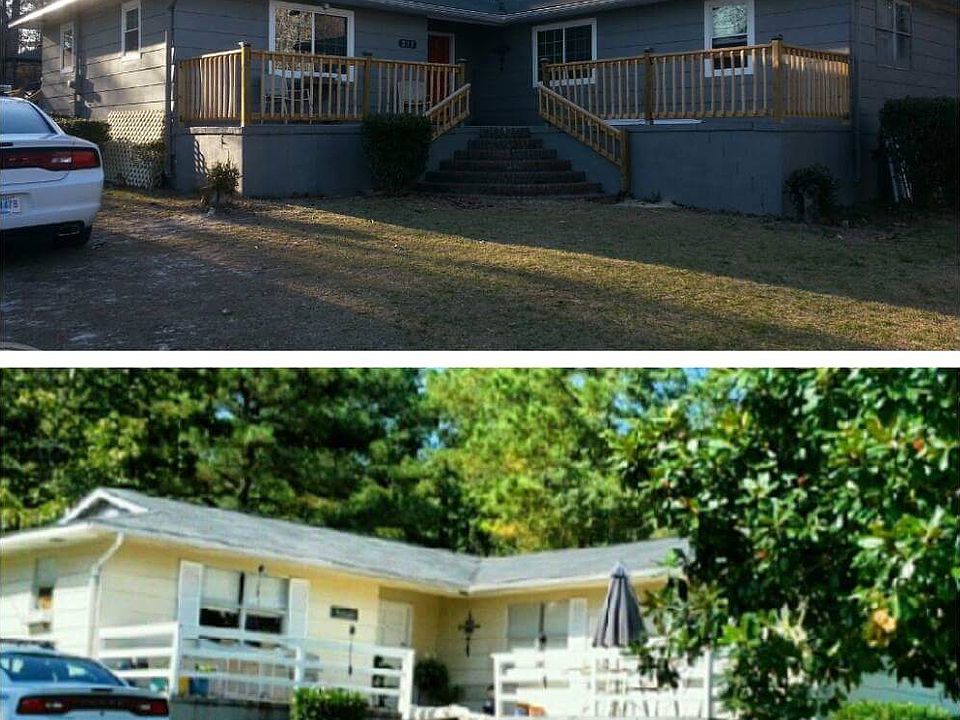before and after front 