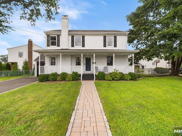 2 Derby Lane, Dumont, NJ 07628