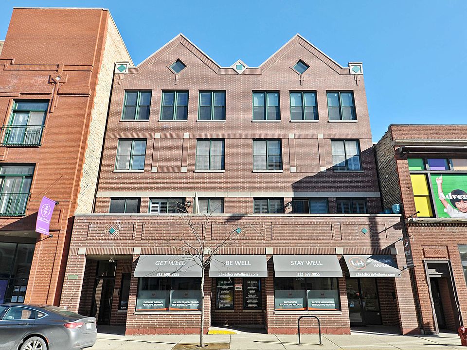 Front View