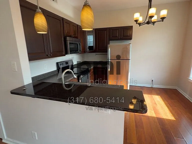 Indy Downtown Colonial Apartments — Photo 96