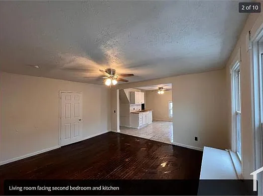 975 Euclid St #2 — Photo 9