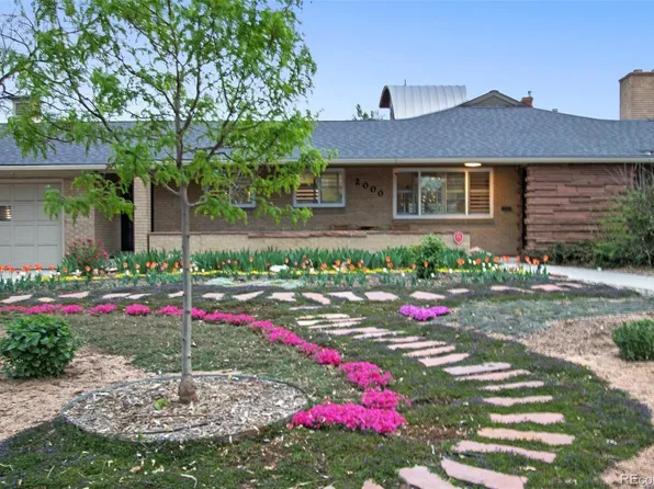 2000 E 21st Avenue, Denver, CO 80205