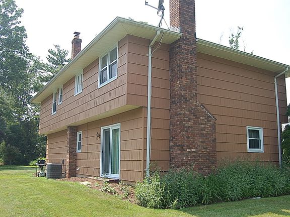 Back and Side Exposure