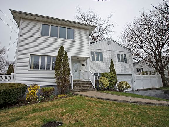 front of expanded split