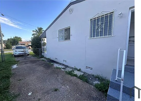 150 NE 170th St — Photo 3