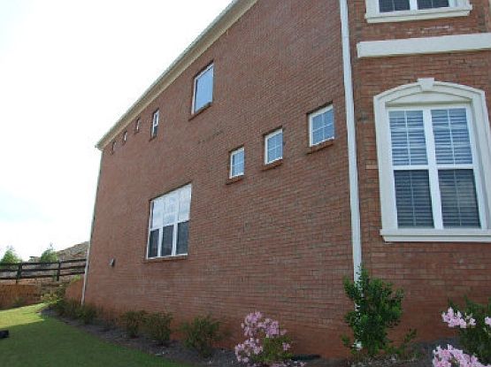 Right Side