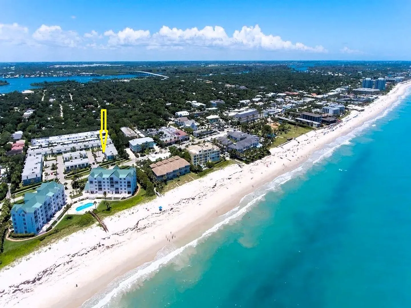 Ocean Towers - Direct Beach Access — Photo 1