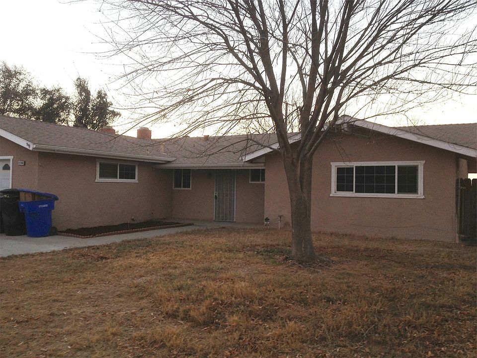 Frontal View