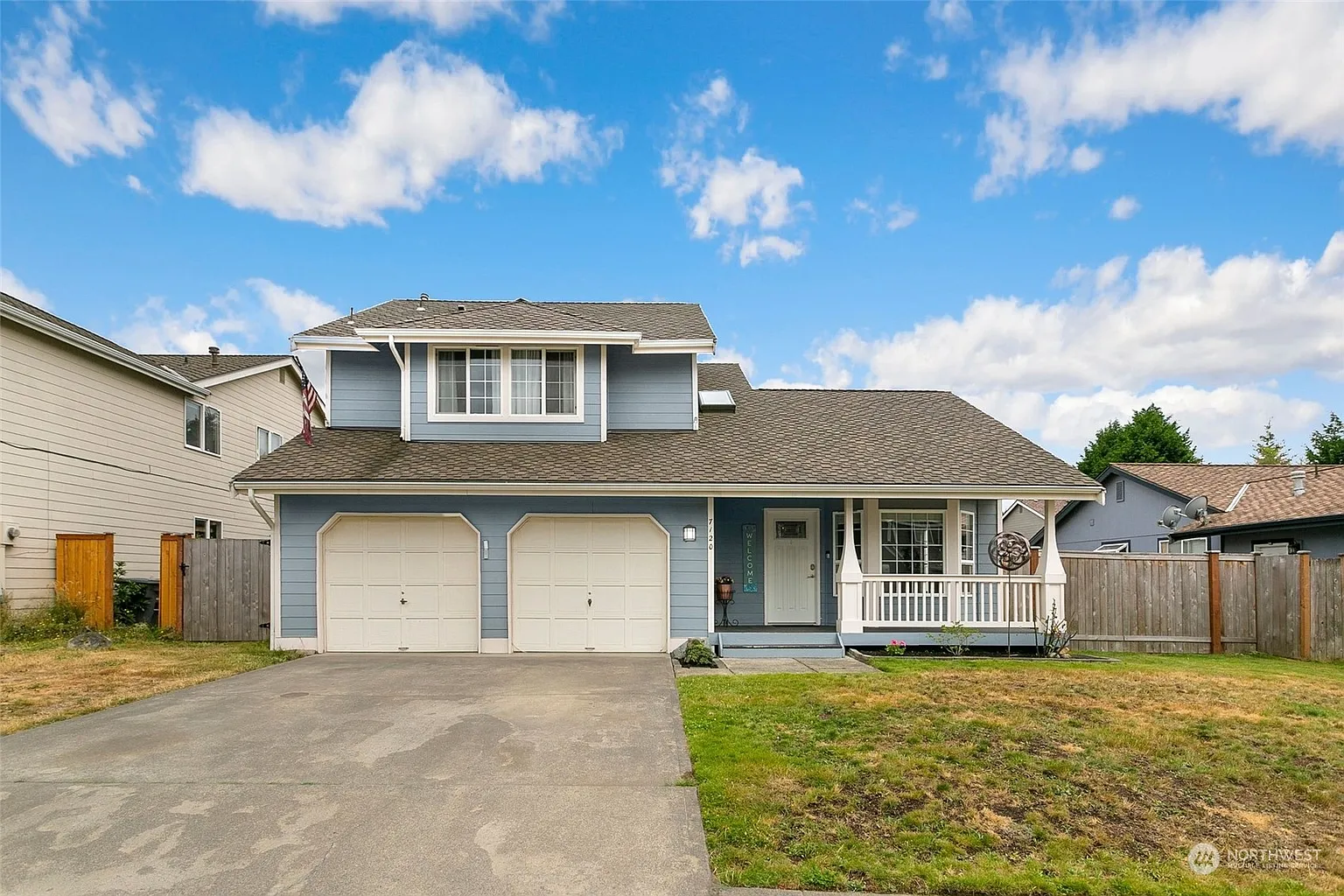 7120 201st Street E photo 1