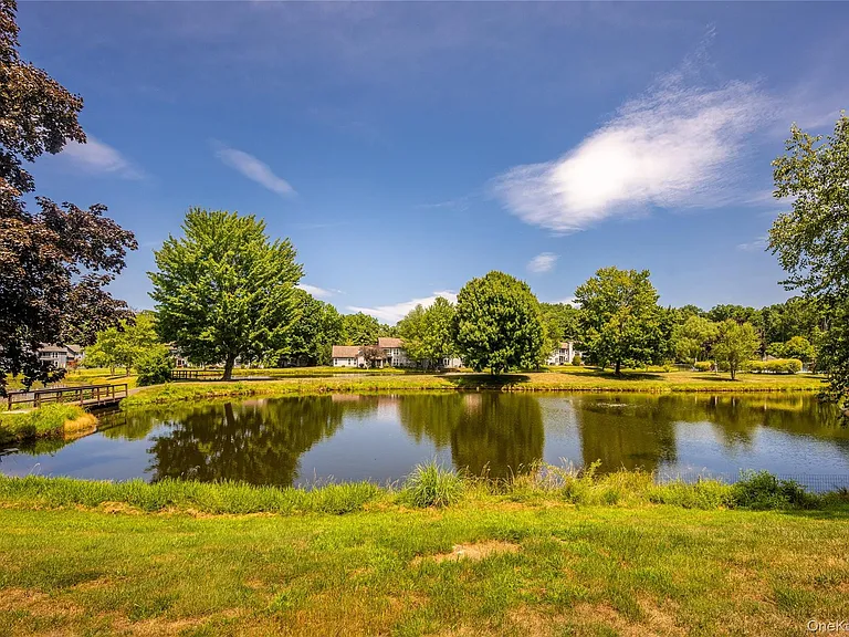 21 Pond Dr W — Photo 10