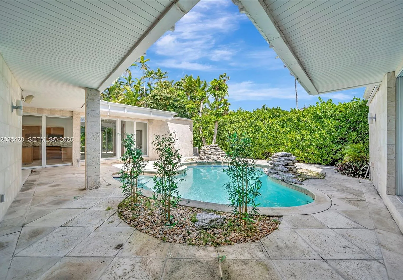 S Hibiscus Dr, Miami Beach — Photo 1