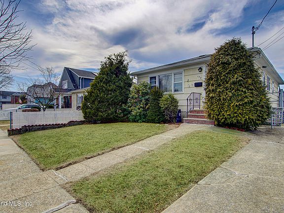 2nd image of 172 Kensington Ave