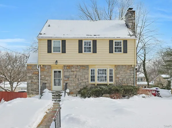 120 Albemarle Road, White Plains, NY 10605