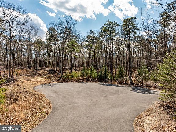 3rd image of 18 Loop Ct