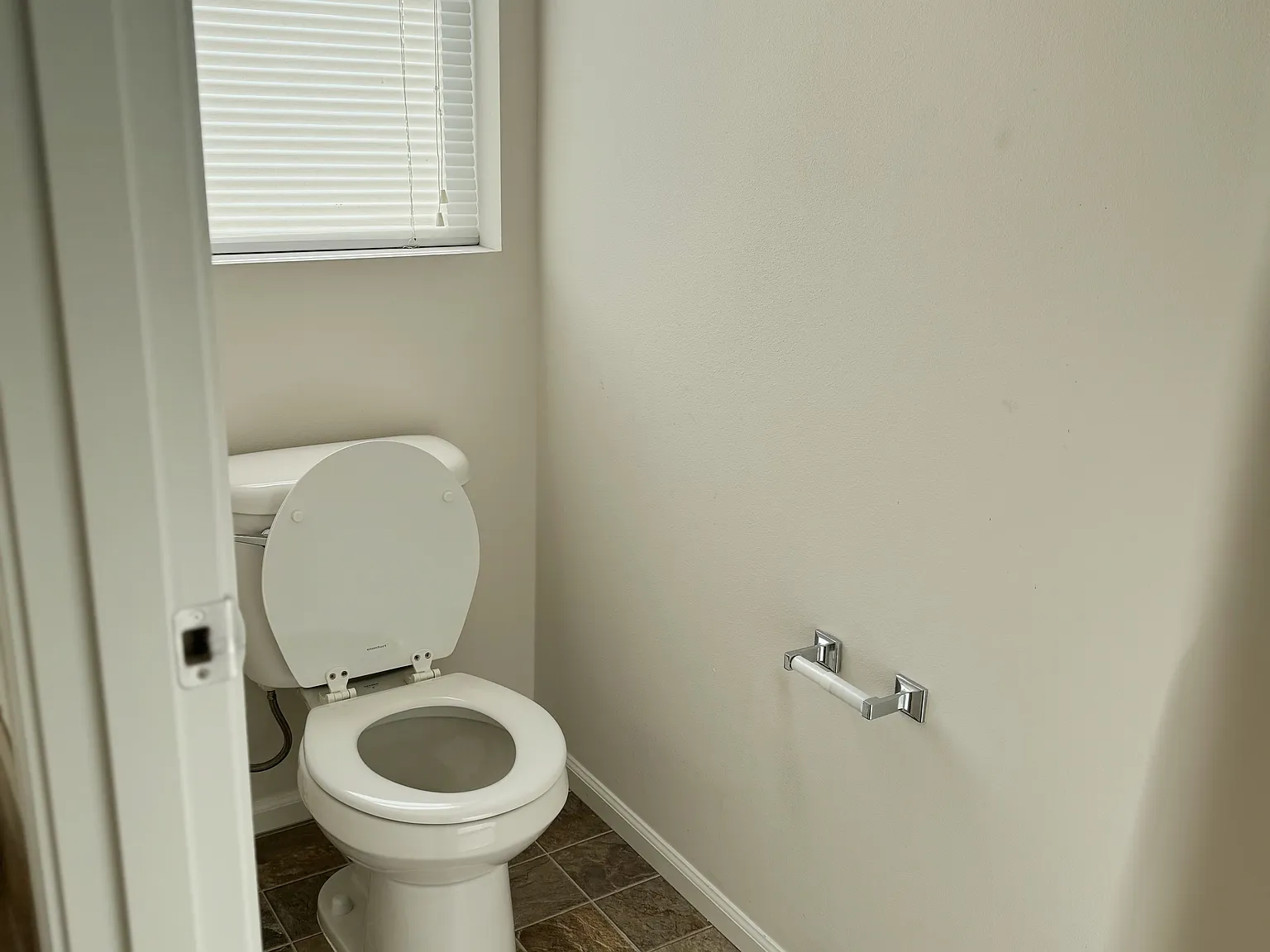 20321 91st Pl S — Photo 4