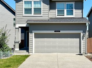 Lipoma, Puyallup, WA 98374