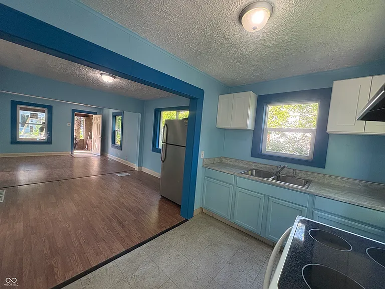 2827 E 18th St — Photo 2
