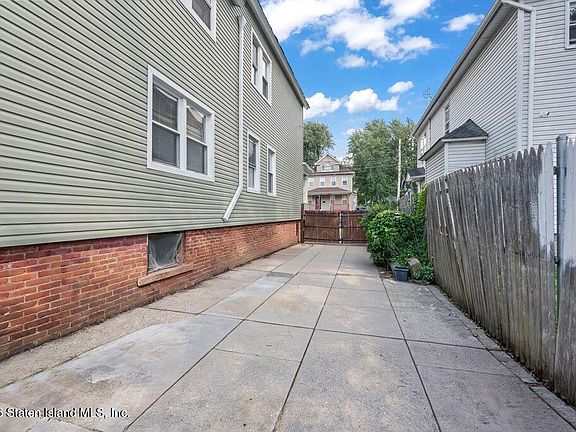 4th image of 170 Treadwell Ave