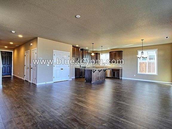 2nd image of 10304 NE 104th Ave