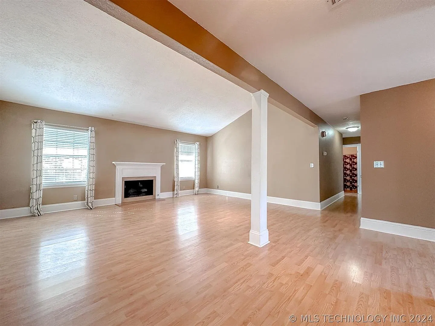 2906 West 63rd Street South — Photo 4