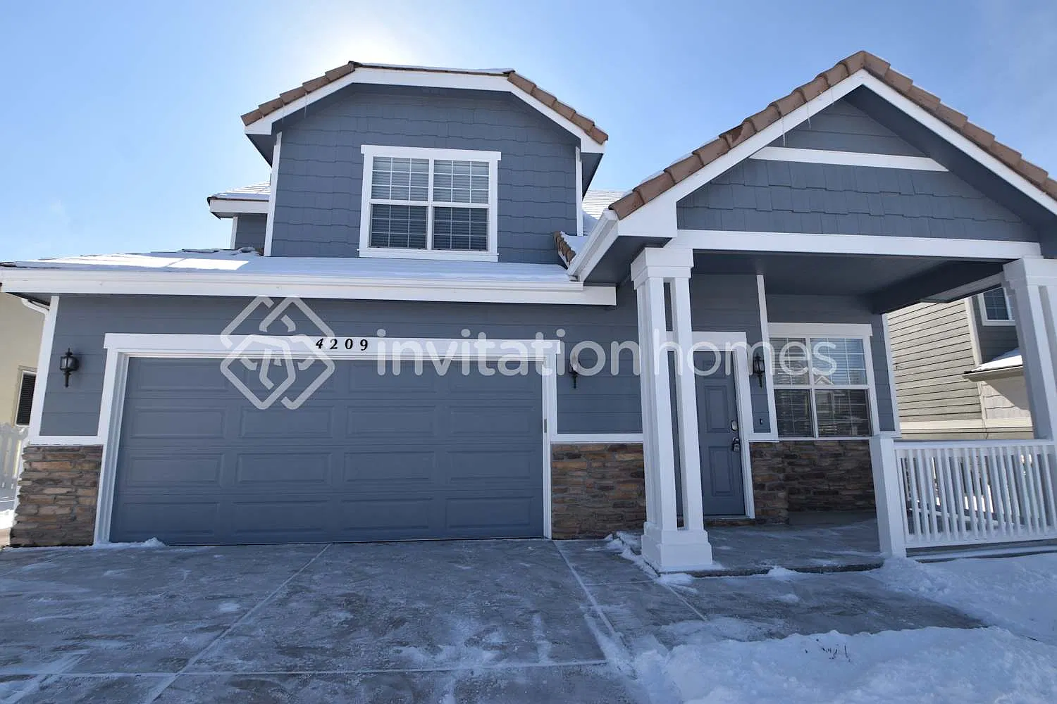 4209 Beautiful Cir Castle Rock, CO 80109 — Photo 1