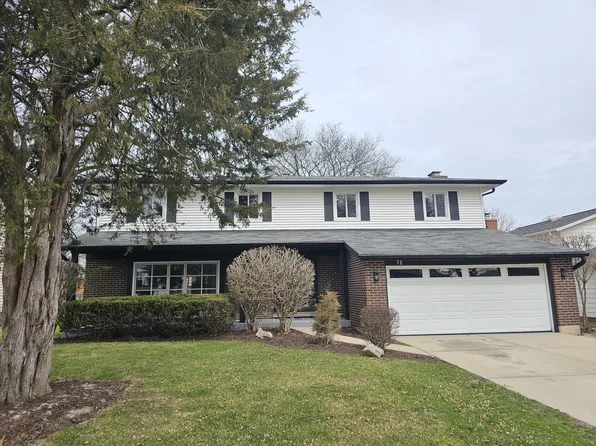 78 Downing Rd, Buffalo Grove, IL 60089