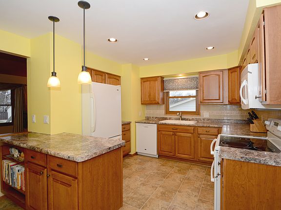 Pendant Lights Over Island