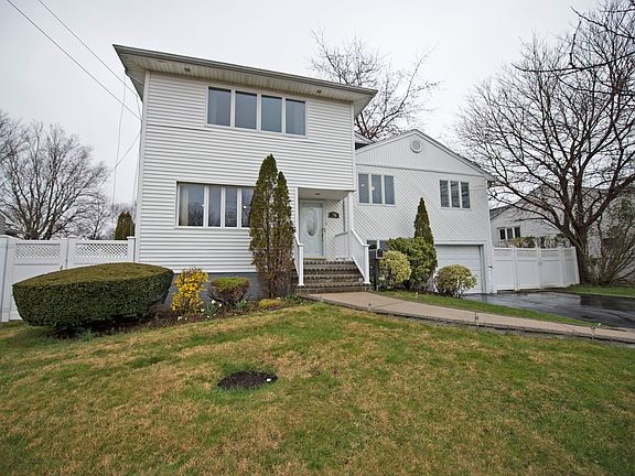 front of expanded split