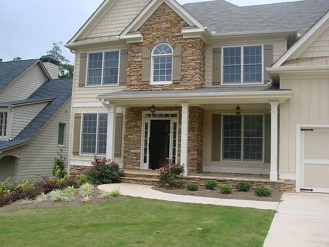 Frontal view