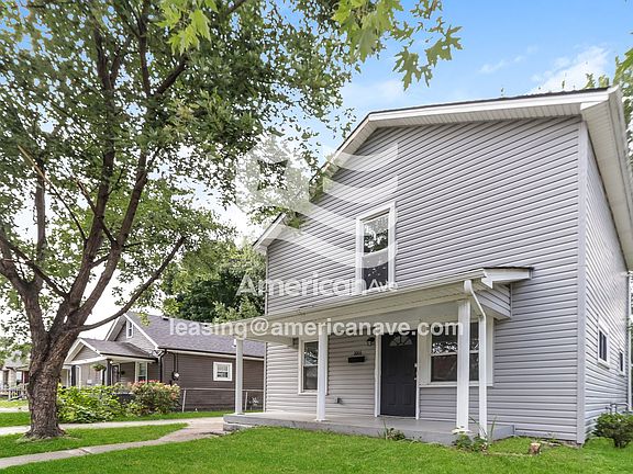 1033617_003_front_view_3.jpg