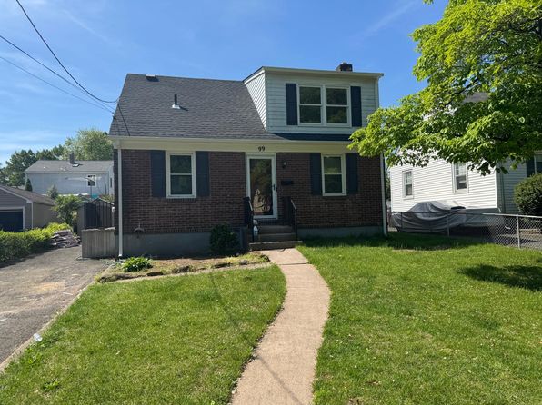 99 Forest Rd, Dumont, NJ 07628