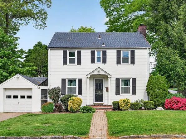 155 White Rd, Scarsdale, NY 10583