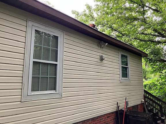 Side view- right side