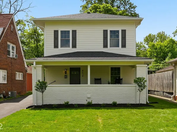 4714 N Kenwood Ave, Indianapolis, IN 46208
